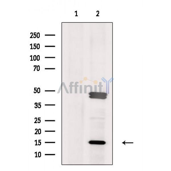 Валидация Affinity DF3373 - 14254