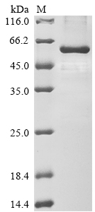 SDS-PAGE