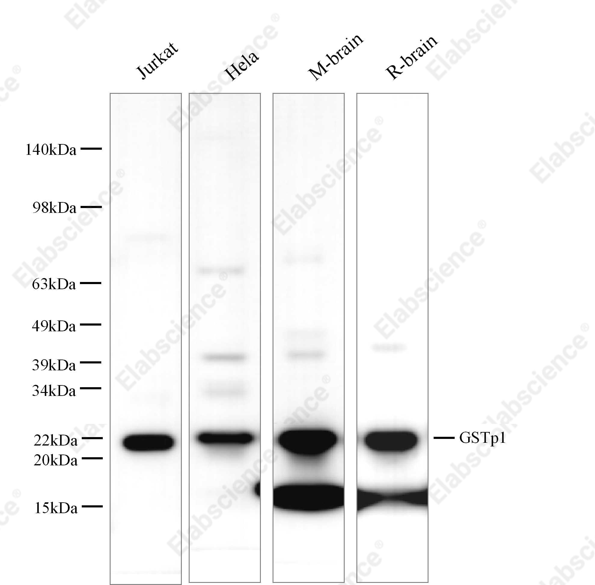 Вестерн-блоттинг, GSTP1, клетки Jurkat, PC-3, HeLa, ткань мозга крысы, ткань почки крысы и ткань мозга мыши