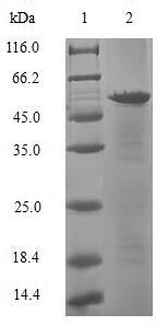 SDS-PAGE