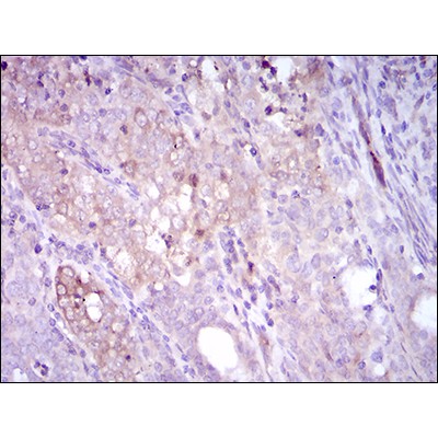 Валидация Affinity BF1005 - 5408