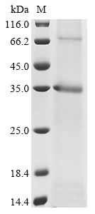 SDS-PAGE