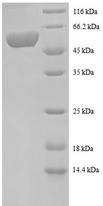 SDS-PAGE
