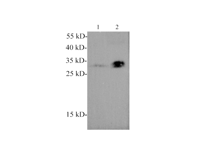Вестерн-блоттинг, Adiponectin, плазма мыши и человека