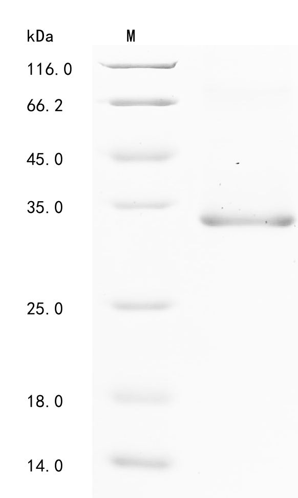SDS-PAGE