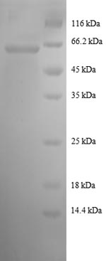 SDS-PAGE