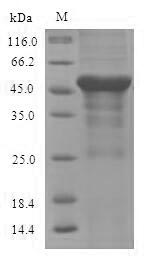 SDS-PAGE