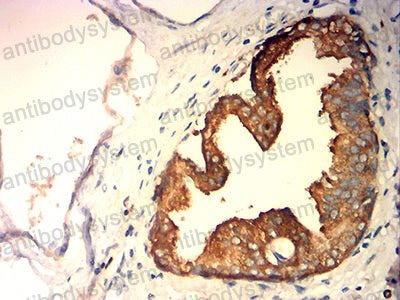 Валидация AntibodySystem RHD37702 (1534)