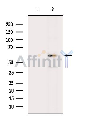 Валидация Affinity DF14389 - 10318