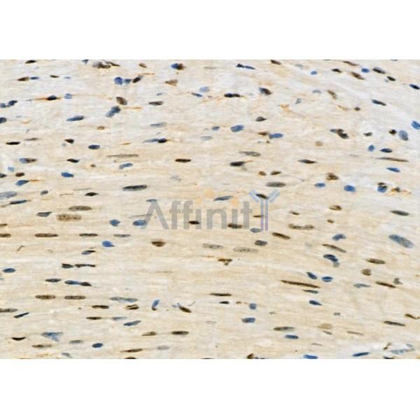 Валидация Affinity DF7431 - 19177