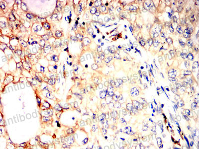 Валидация AntibodySystem RHC24105 (815)