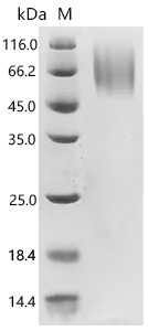SDS-PAGE