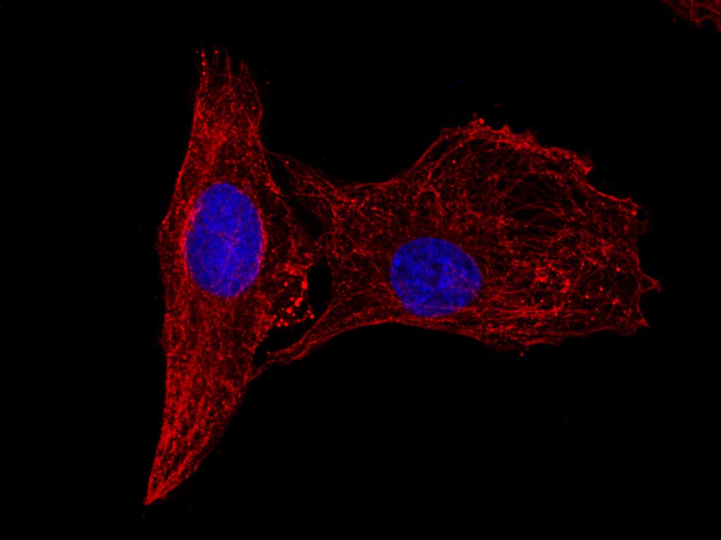Валидация Elabscience AN005310L