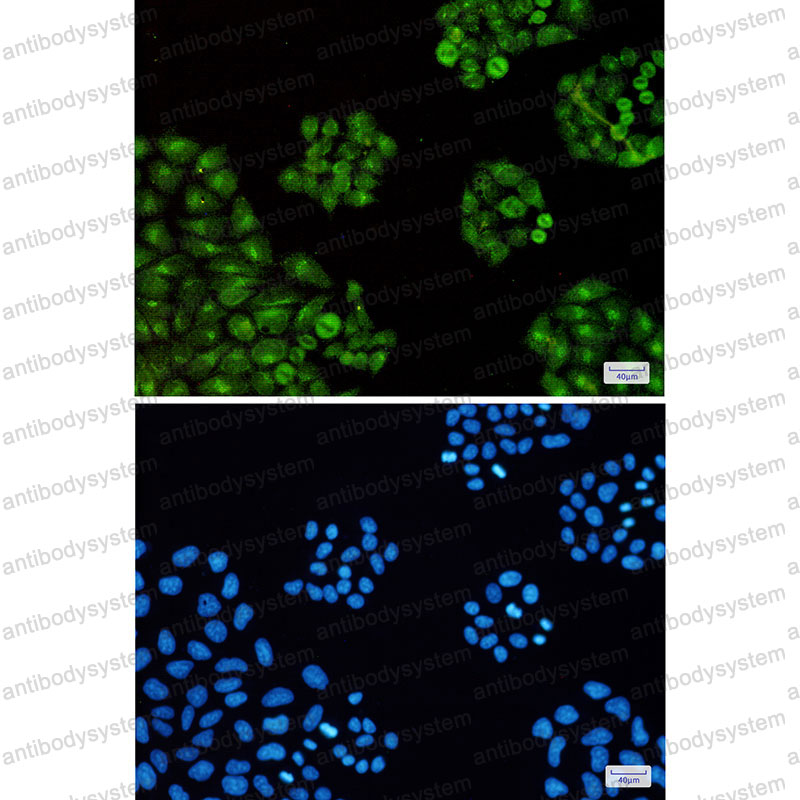 Валидация IF - AntibodySystem RHN87301
