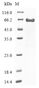 SDS-PAGE
