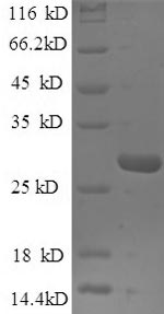 SDS-PAGE