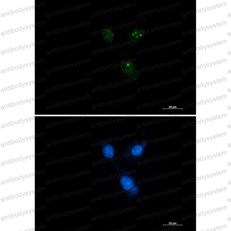 Валидация IF - AntibodySystem RHE70504