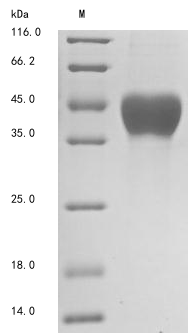 SDS-PAGE
