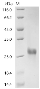 SDS-PAGE