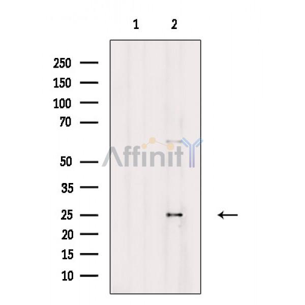 Валидация Affinity DF8504 - 20362