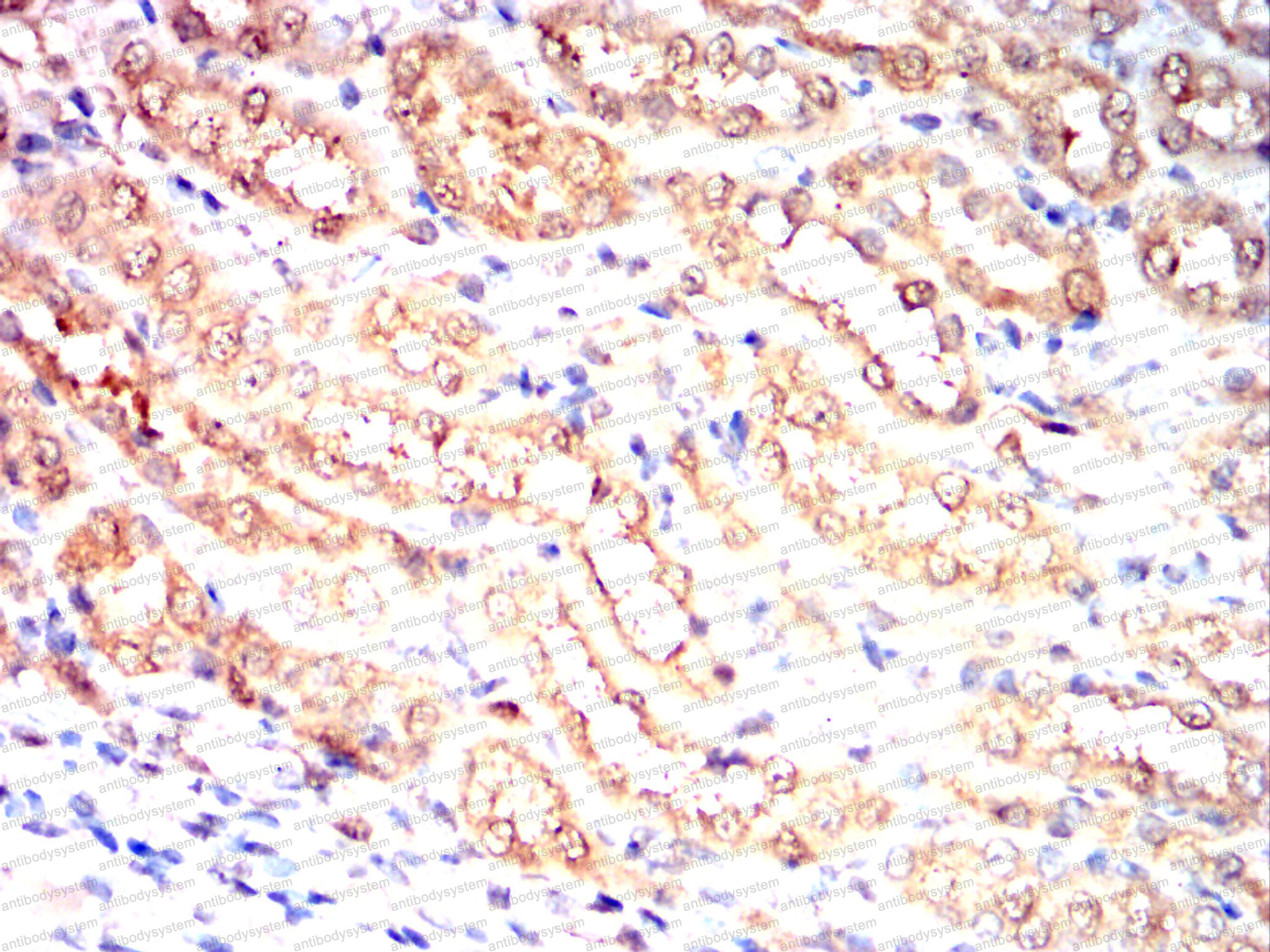 Валидация AntibodySystem RHF04003 (2434)