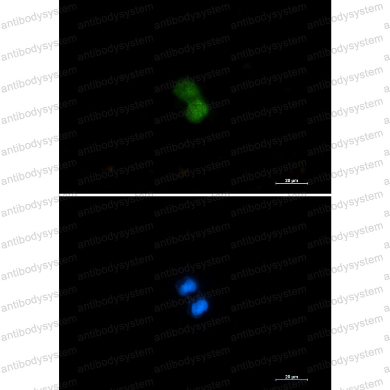 Валидация IF - AntibodySystem RHB58801