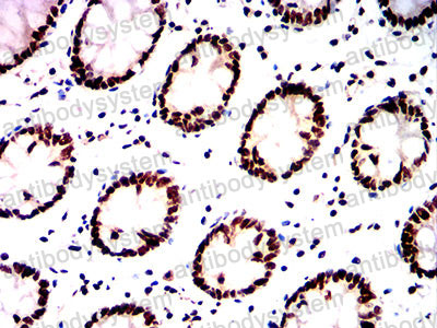 Валидация AntibodySystem RHG58203 (3006)