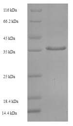 SDS-PAGE