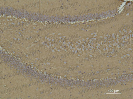 Валидация AntibodySystem RHD50005 (1614)