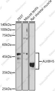 Вестерн-блоттинг, ALKBH5, различные клеточные линии