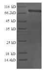 SDS-PAGE