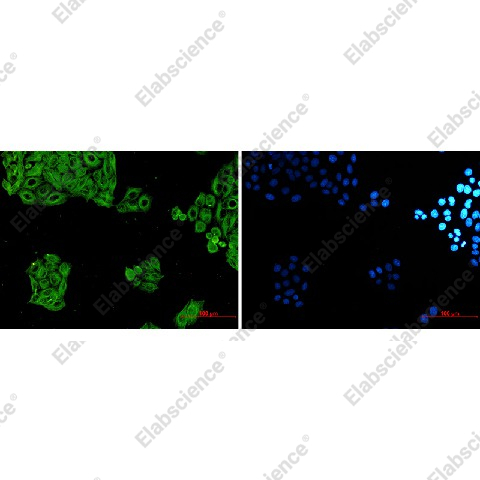 Иммунофлуоресценция, alpha Tubulin, клетки HeLa
