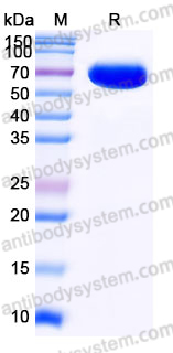 AHK13703, SDS-PAGE