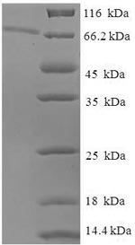 SDS-PAGE