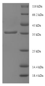 SDS-PAGE