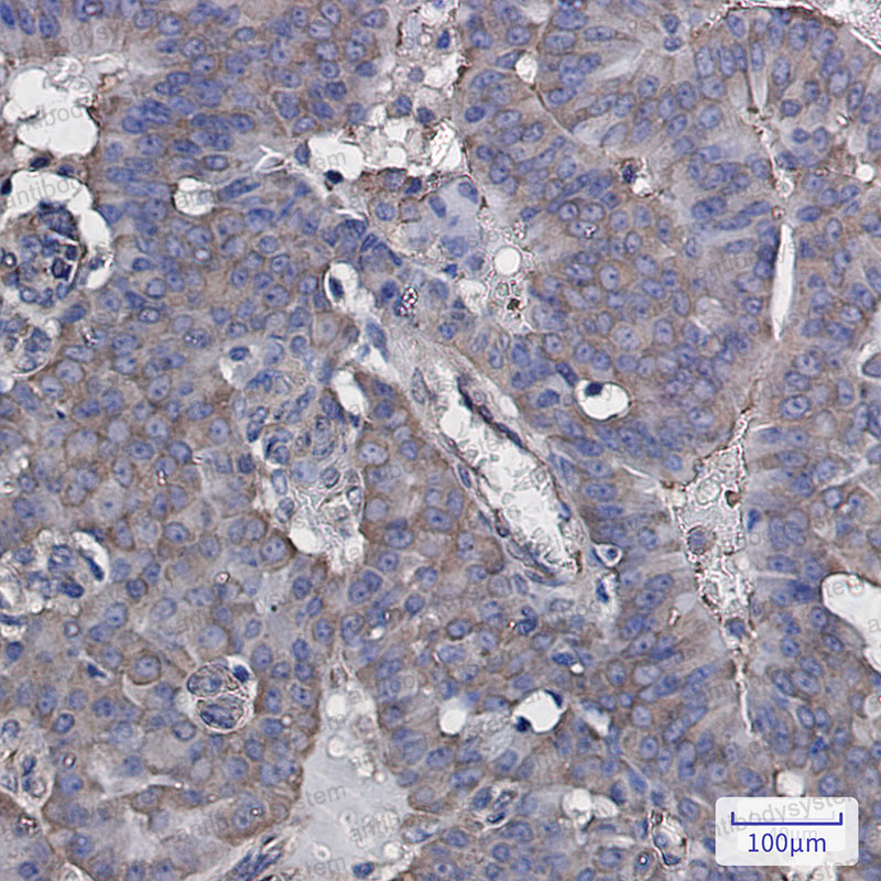 Валидация AntibodySystem RHF14403