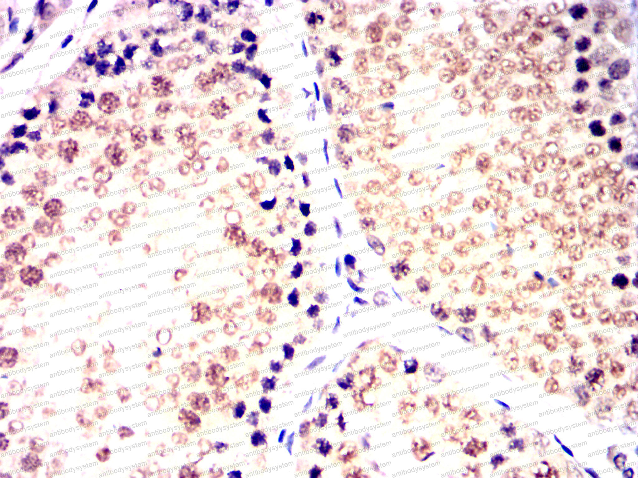 Валидация AntibodySystem RHE78702