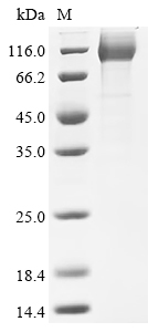 SDS-PAGE