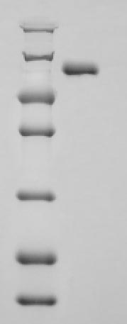 SDS-PAGE