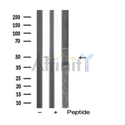 Валидация Affinity DF5218 - 17217