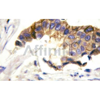 Валидация Affinity AF6098 - 3306