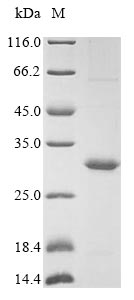 SDS-PAGE