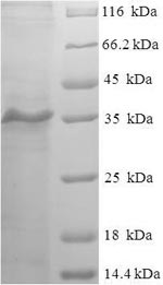SDS-PAGE