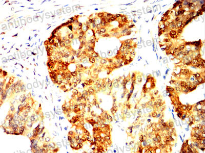 Валидация AntibodySystem RHC44502 (1034)
