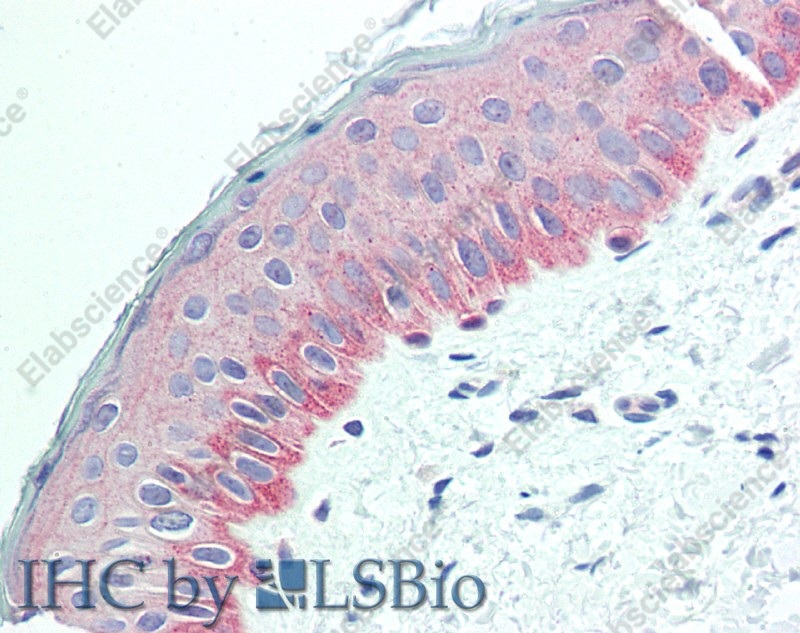 Иммуногистохимия, NECTIN4, ткань кожи человека