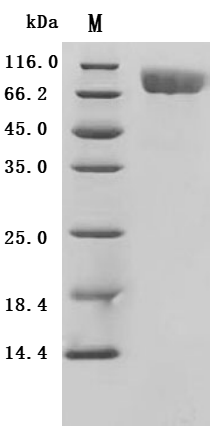 SDS-PAGE