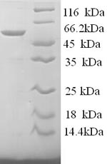 SDS-PAGE