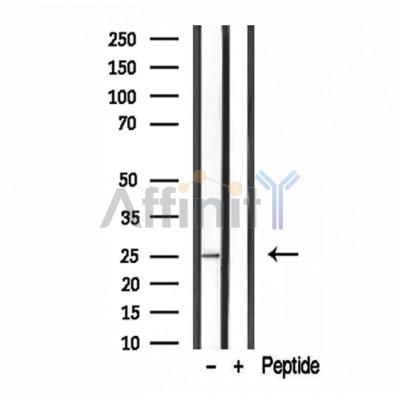 Валидация Affinity DF12110 - 6240