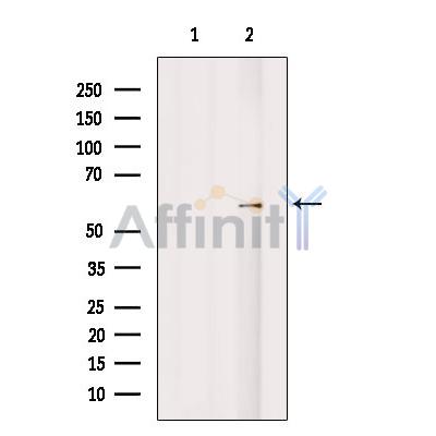 Валидация Affinity DF8926 - 21067