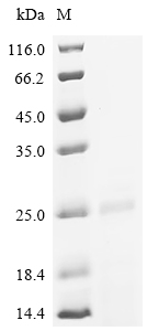 SDS-PAGE
